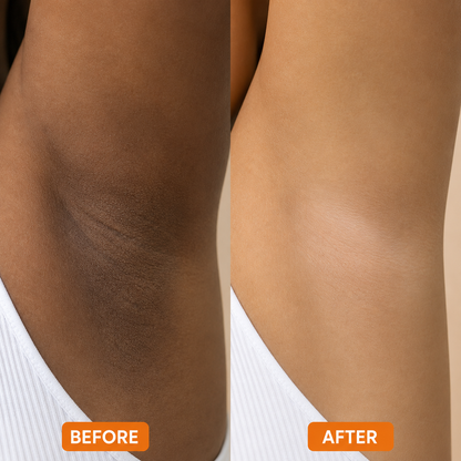 GlowVera™ - Aloe Enzyme Exfoliating Gel